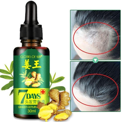 7Days Hair Regrowth Serum