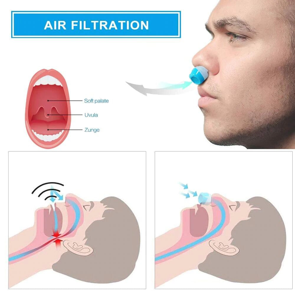 Airing: The First Hoseless, Maskless, Micro-Cpap